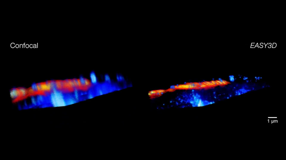 Mouse inner ear hair cells imaged with super-resolution in all three dimensions using EASY3D